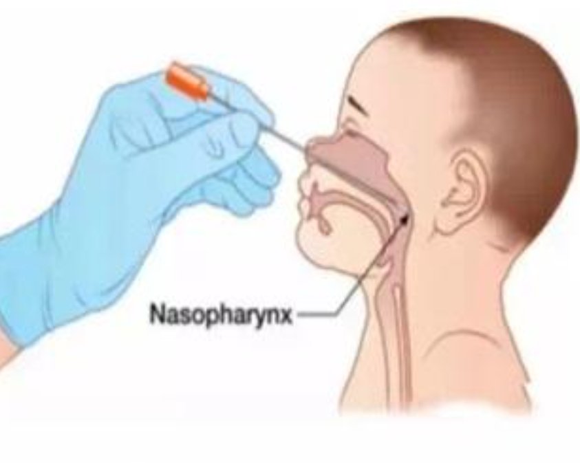 9000名乘客因鼻拭子重复使用受害,谁应该负主要责任?