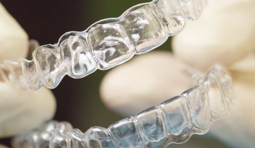 牙套是什么样的图片