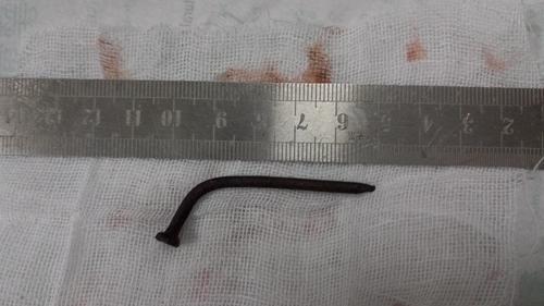 5公分等于多少厘米