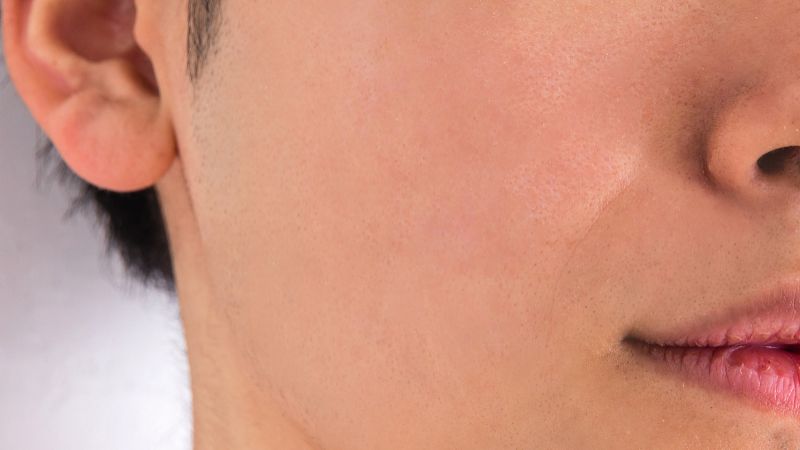 听说维生素B6可以用来去粉刺和痘痘,