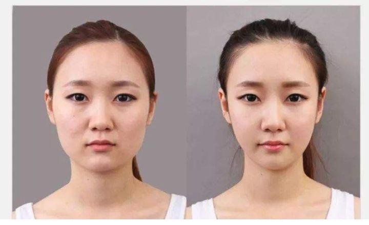 徒手整形是真的吗?