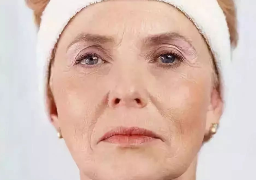 假性皱纹与真皱纹的区别在哪里