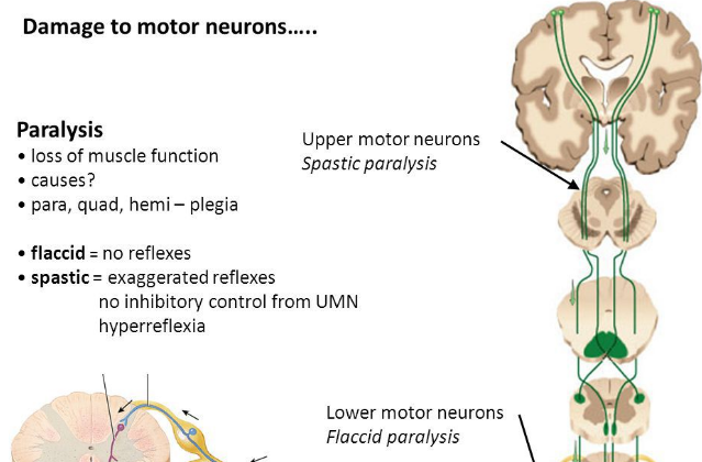 薄束和楔束是干嘛的?