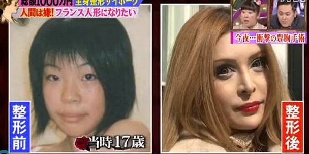 日本整容技术好吗?