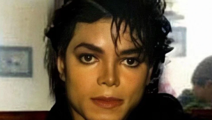 迈克杰克逊为什么皮肤变白了?