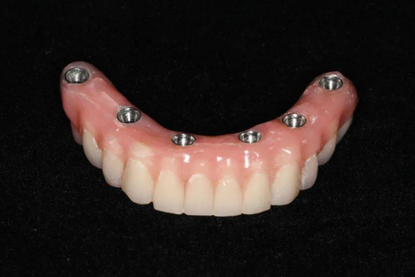 建议规范种牙收费并纳入医保,遇到什么问题需要种牙?