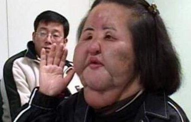 日本整容技术好吗?