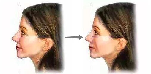 用什么方法美白除皱的效果最好