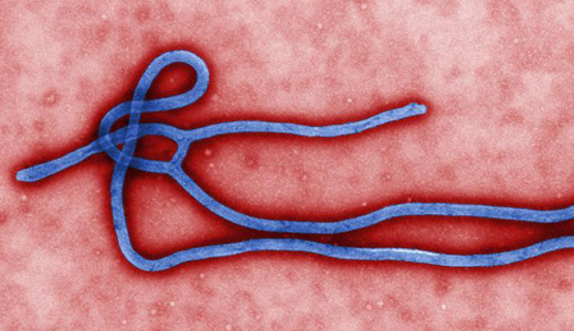 美国猴痘病例激增,超越西班牙成为全球第一,这种病毒的致死率有多高?