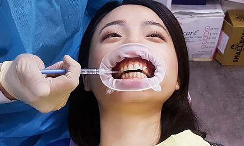 小伙拔牙10天后脑出血死亡,这是怎么回事?