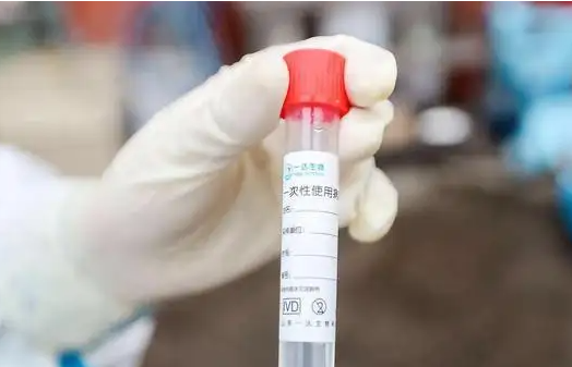 逝者火化需提供核酸证明,你认为有必要吗?