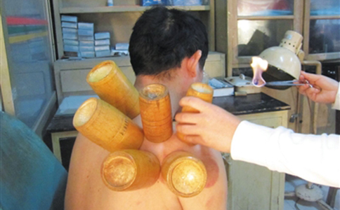 拔火罐都会对人体造成哪些副作用？