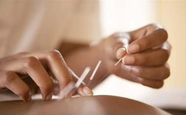 针灸都有哪些功效？