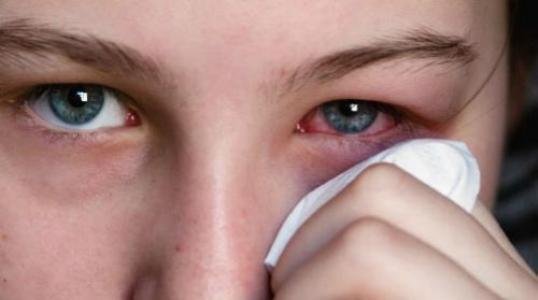 人为什么会长针眼？