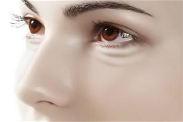 黑眼圈是由身体什么毛病引起