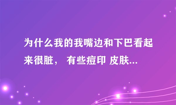 为什么我的我嘴边和下巴看起来很脏， 有些痘印 皮肤暗淡 谁能帮我觉下，我很苦恼