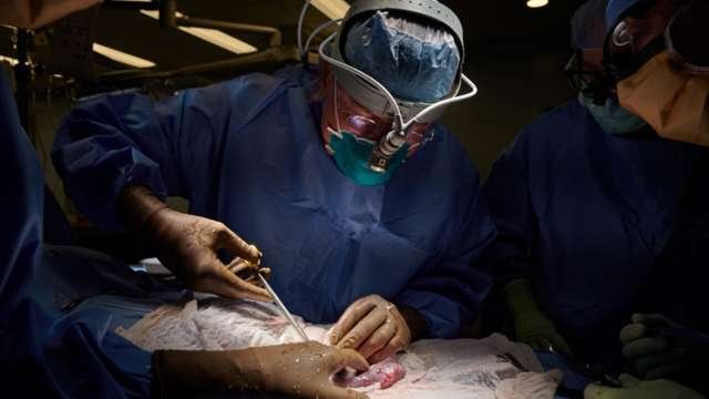 美国猪肾移植人体实验成功，这例手术标志着什么？