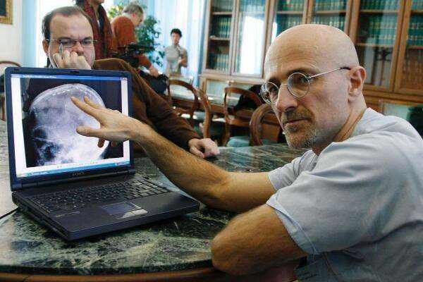 以人类现在的技术,能实现换头手术吗?