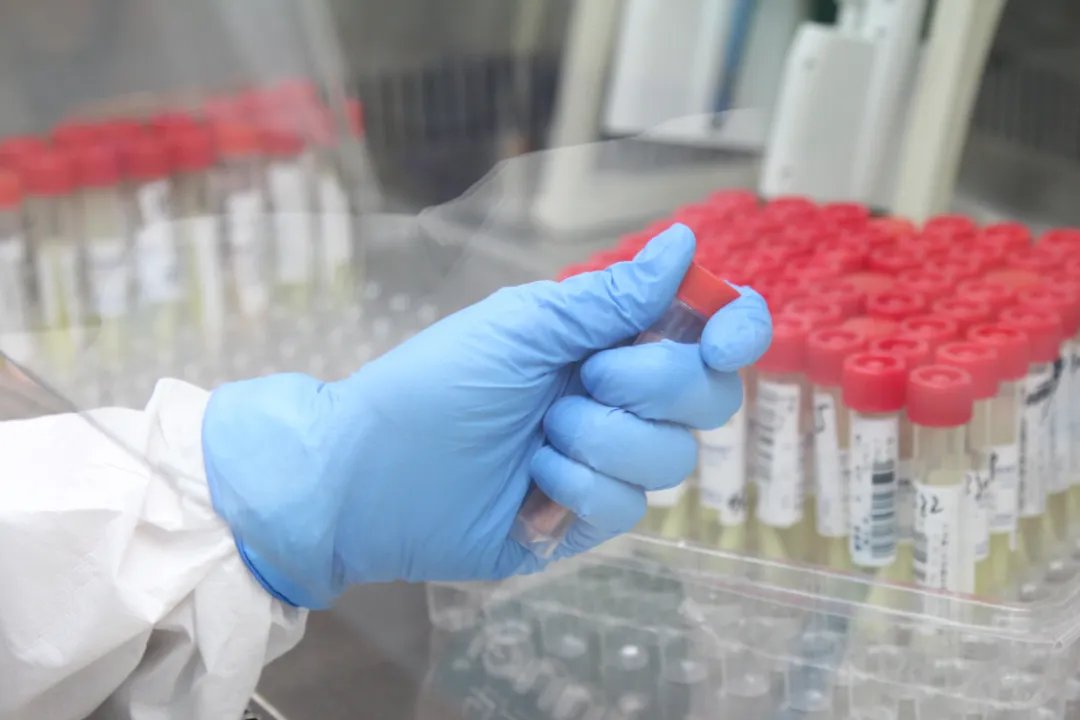 张文宏谈上海防控策略，上海本轮疫情拐点何时出现？