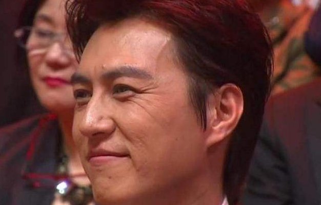 男士鱼尾纹怎么处理?