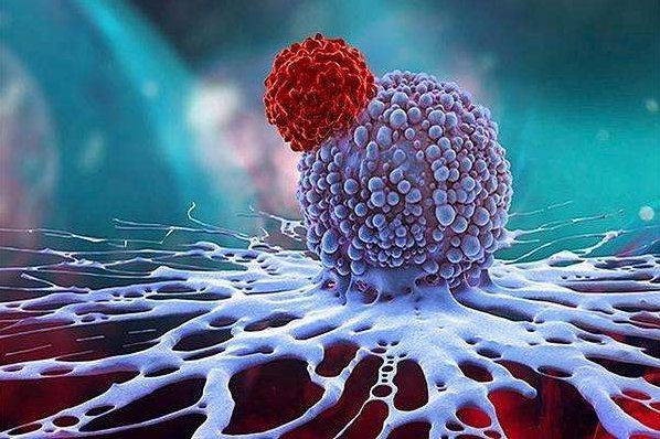 癌症早期几乎无症状，这是为什么？