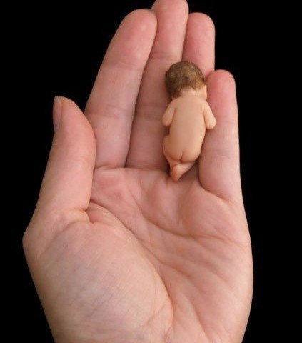 南昌出生仅4天婴儿被蜱虫咬伤，被其咬伤后该如何处理？